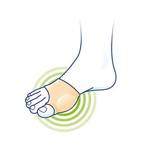 LP Support 350 Halluxcare Bunion Sleeve - Medium - Image 2