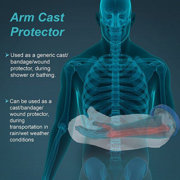 Tynor Cast Cover For Arm, White (1 Unit) - Image 7